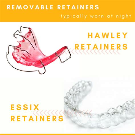 A guide to all retainers by Chris .